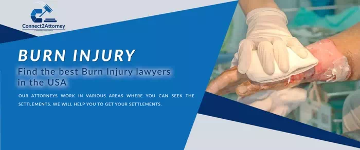 burn injury attorney