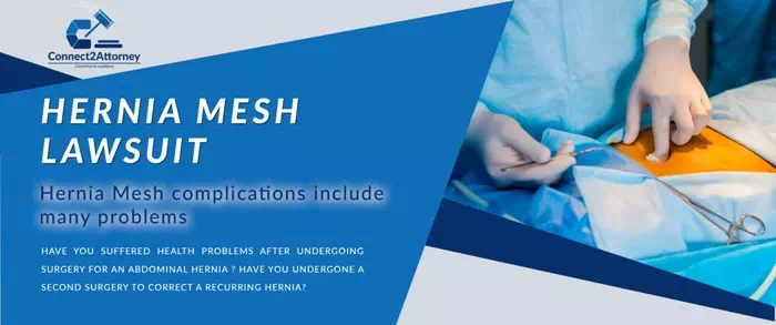 henia mesh class action lawsuit