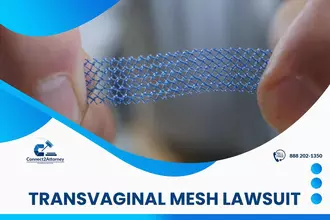 TRANSVAGINAL MESH LAWSUIT